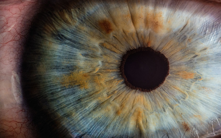 Kto może skorzystać z laserowej korekcji wzroku?